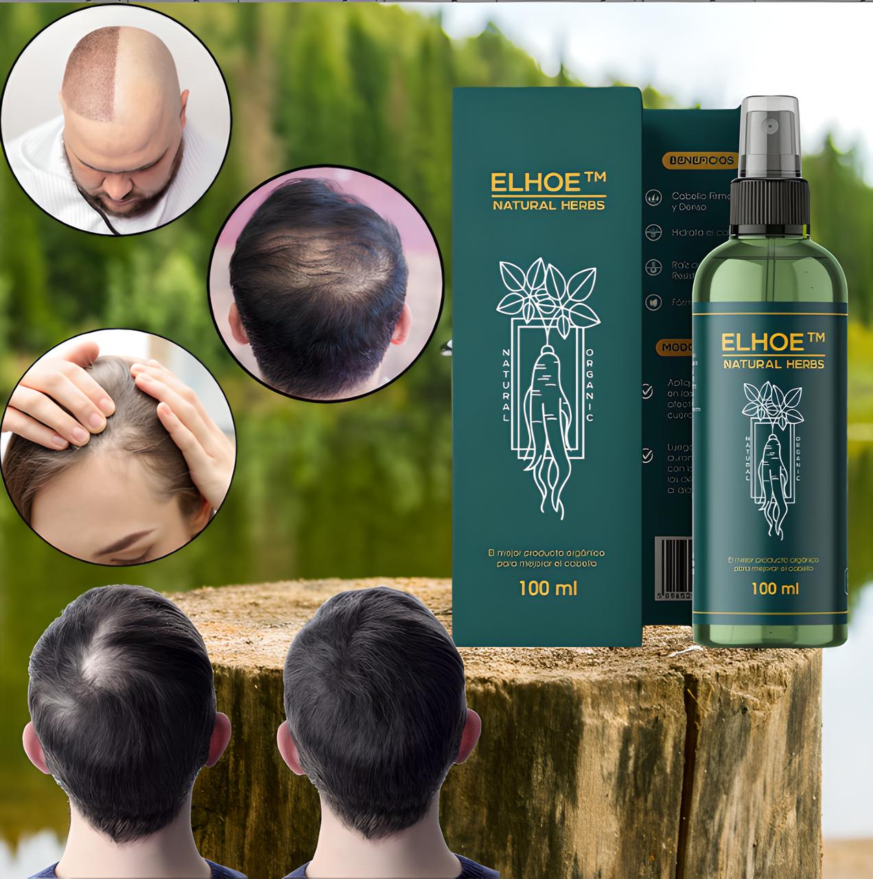 Tónico Revitalizante para el Crecimiento del Cabello – Fortalece y Detiene la Caída | MisterTodo Perú - MisterTodo